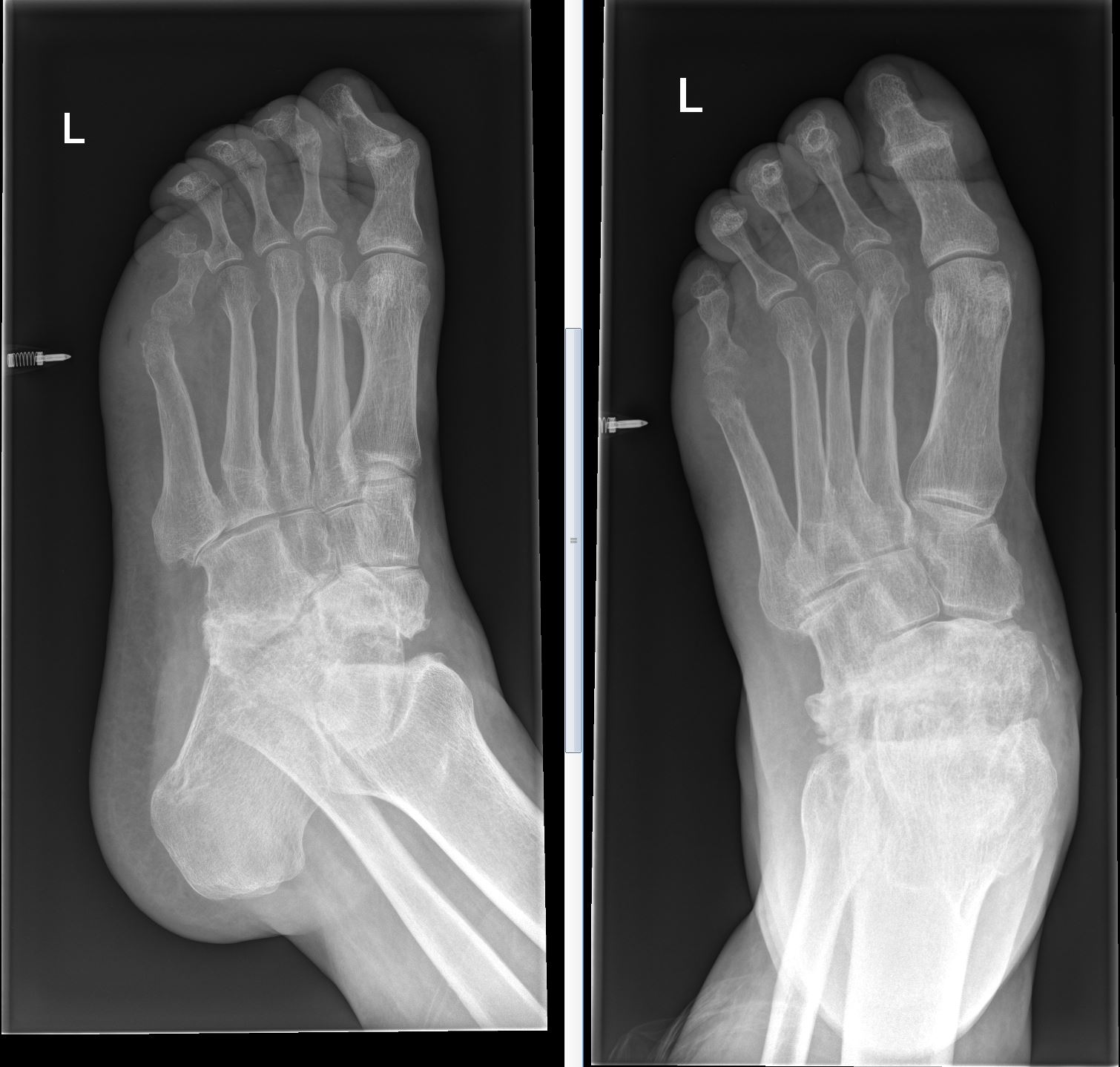 Case 12